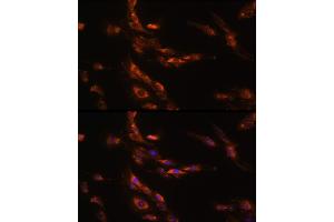 Immunofluorescence analysis of C6 cells using G Rabbit pAb (ABIN7267344) at dilution of 1:100 (40x lens). (GABRg1 抗体  (AA 200-260))