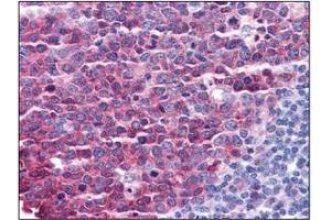 Image no. 3 for anti-Stathmin 1 (STMN1) (C-Term) antibody (ABIN374648) (Stathmin 1 抗体  (C-Term))