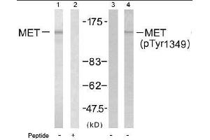 Image no. 1 for anti-Met Proto-Oncogene (MET) (pTyr1349) antibody (ABIN196990) (c-MET 抗体  (pTyr1349))