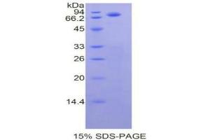 SDS-PAGE analysis of Human Cadherin, Epithelial Protein.