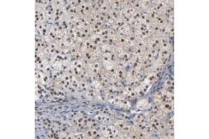 Immunohistochemical staining of human adrenal gland with FOXN2 polyclonal antibody  shows nuclear positivity in cortical cells at 1:50-1:200 dilution. (FOXN2 抗体)