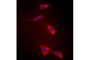 Immunofluorescence (IF) image for anti-Solute Carrier Family 27 (Fatty Acid Transporter), Member 5 (SLC27A5) (Center) antibody (ABIN7299592)