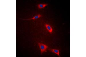 Immunofluorescent analysis of FATP5 staining in HeLa cells. (SLC27A5 抗体  (Center))