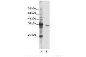 Image no. 2 for anti-Exosome Component 3 (EXOSC3) (AA 81-130) antibody (ABIN6736236) (EXOSC3 抗体  (AA 81-130))