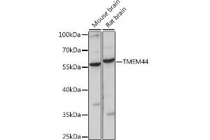Western blot analysis of extracts of various cell lines, using TMEM44 antibody (ABIN7270964) at 1:1000 dilution. (TMEM44 抗体  (AA 110-260))