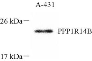 Western blot analysis of PNG (ABIN7075269),at dilution of 1: 1000 (PPP1R14B 抗体)