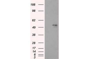 Image no. 6 for anti-Aldehyde Dehydrogenase 3 Family, Member A1 (ALDH3A1) antibody (ABIN1496591) (ALDH3A1 抗体)