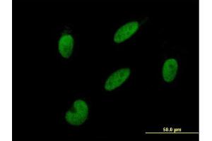 Immunofluorescence of purified MaxPab antibody to GTF2A2 on HepG2 cell. (GTF2A2 抗体  (AA 1-109))