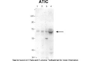 Western Blotting (WB) image for anti-5-Aminoimidazole-4-Carboxamide Ribonucleotide Formyltransferase/IMP Cyclohydrolase (ATIC) (N-Term) antibody (ABIN2782481)