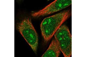 Immunofluorescent staining of RH-30 cells with ARPP-21 polyclonal antibody  (Green) shows localization to nucleoli and cytosol. (ARPP21 抗体)