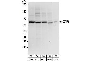 anti-Zinc Finger Protein 622 (ZNF622) (AA 25-75) antibody