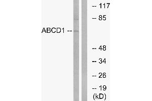 Western blot analysis of extracts from Jurkat cells, using ABCD1 antibody. (ABCD1 抗体)