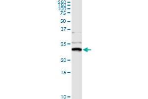 Immunoprecipitation of NME1 transfected lysate using anti-NME1 monoclonal antibody and Protein A Magnetic Bead , and immunoblotted with NME1 MaxPab rabbit polyclonal antibody. (NME1 抗体  (AA 43-152))