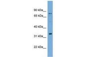 Image no. 1 for anti-Sperm Acrosome Associated 1 (SPACA1) (AA 51-100) antibody (ABIN6745571)