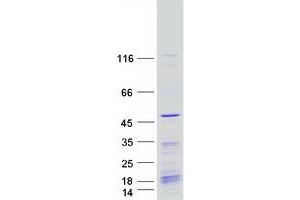 Western Blotting (WB) image for KIN, Antigenic Determinant of RecA Protein Homolog (KIN) protein (Myc-DYKDDDDK Tag) (ABIN2724254)