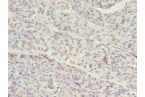 Immunohistochemistry of paraffin-embedded human pancreatic tissue using ABIN7155517 at dilution of 1:100 (SETD7 抗体  (AA 1-218))