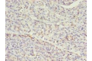 Immunohistochemistry of paraffin-embedded human pancreatic tissue using ABIN7155517 at dilution of 1:100