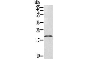 Gel: 12 % SDS-PAGE,Lysate: 40 μg,Primary antibody: ABIN7192768(TEX37 Antibody) at dilution 1/200 dilution,Secondary antibody: Goat anti rabbit IgG at 1/8000 dilution,Exposure time: 20 seconds (TEX37 抗体)
