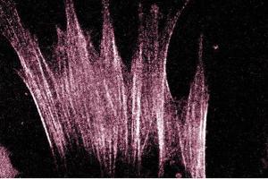 Immunofluorescence staining of human fibroblasts. (ARHGAP5 抗体  (AA 1102-1214))