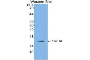 WB of Protein Standard: different control antibodies against Highly purified E. (NOS1 ELISA 试剂盒)