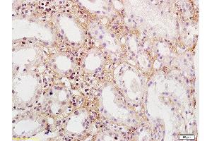 Formalin-fixed and paraffin embedded human kidney labeled with Rabbit Anti-PDGFBB Polyclonal Antibody, Unconjugated  at 1:200 followed by conjugation to the secondary antibody and DAB staining (PDGF-BB Homodimer (AA 151-241) 抗体)