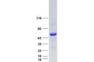Western Blotting (WB) image for Lysophosphatidylcholine Acyltransferase 2 (LPCAT2) protein (Myc-DYKDDDDK Tag) (ABIN2724869)