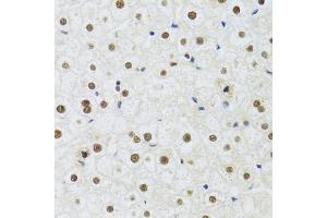 Immunohistochemistry of paraffin-embedded human liver using DDB1 Antibody (ABIN5971498) at dilution of 1/100 (40x lens). (DDB1 抗体)