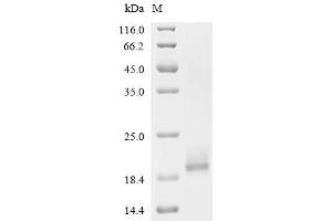 (Tris-Glycine gel) Discontinuous SDS-PAGE (reduced) with 5 % enrichment gel and 15 % separation gel.