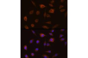 Immunofluorescence (IF) image for anti-Glutathione S-Transferase theta 1 (GSTT1) (AA 1-240) antibody (ABIN3021871)