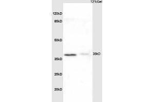 L1 rat liver lysate L2 mouse kidney lysates probed with Anti NDUFA8 Polyclonal Antibody, Unconjugated (ABIN751723) at 1:200 overnight at 4 °C. (NDUFA8 抗体  (AA 101-172))