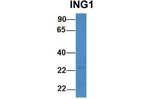 Host:  Rabbit  Target Name:  ING1  Sample Type:  Human 721_B  Antibody Dilution:  1. (ING1 抗体  (N-Term))