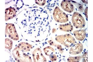 Immunohistochemical analysis of paraffin-embedded kidney tissues using HIF2a mouse mAb with DAB staining. (EPAS1 抗体  (AA 680-870))