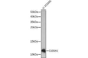 Western blot analysis of extracts of U-251MG cells, using S100 Rabbit pAb (ABIN7270126) at 1:1000 dilution. (S100A5 抗体  (AA 1-92))