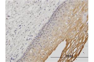 Immunoperoxidase of monoclonal antibody to MUC1 on formalin-fixed paraffin-embedded human uterine cervix. (MUC1 抗体  (AA 315-420))
