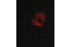 ABIN6268884 staining MCF-7 cells by ICC/IF. (CTNNA1 抗体  (C-Term))