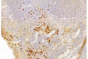 ABIN6261731 and ABIN6269136 at 1/100 staining Mouse spleen tissue by IHC-P. (FGFR1 抗体  (C-Term))