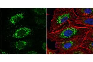 ICC/IF Image ALDH2 antibody detects ALDH2 protein at mitochondria by immunofluorescent analysis. (ALDH2 抗体  (Center))