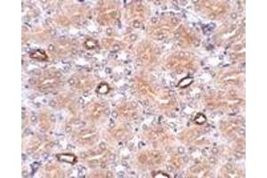 Immunohistochemistry (IHC) image for anti-Notum Pectinacetylesterase Homolog (NOTUM) (N-Term) antibody (ABIN1031488) (NOTUM 抗体  (N-Term))