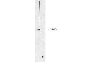 Image no. 1 for anti-Protein Phosphatase 2, Regulatory Subunit B, beta (PPP2R2B) (AA 2-14), (N-Term) antibody (ABIN264942)