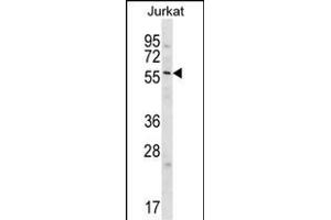 GPC3 Antibody  (cat (ABIN652202 and ABIN2840751)) western blot analysis in Jurkat cell line lysates (35 μg/lane). (Glypican 3 抗体  (C-Term))