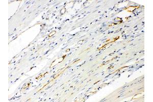 Immunohistochemistry (IHC) image for anti-Angiopoietin-Like 2 (ANGPTL2) (AA 275-312), (Middle Region) antibody (ABIN5518733)