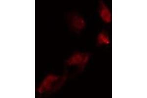 ABIN6275542 staining  COLO205 cells by IF/ICC. (TLK2 抗体  (Internal Region))