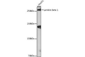 Laminin beta 1 抗体