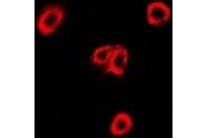 Immunofluorescent analysis of OXA1L staining in U2OS cells. (OXA1L 抗体)