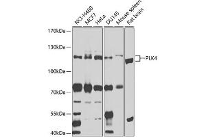 Western blot analysis of extracts of various cell lines, using PLK4 antibody (ABIN6132496, ABIN6145781, ABIN6145782 and ABIN6225196) at 1:1000 dilution. (PLK4 抗体  (AA 641-970))