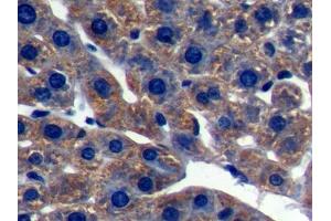 DAB staining on IHC-P; Samples: Rat Liver Tissue (LSS 抗体  (AA 101-250))