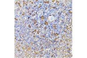 IHC Analysis using ABIN6140687 (FLT1 抗体  (AA 20-300))