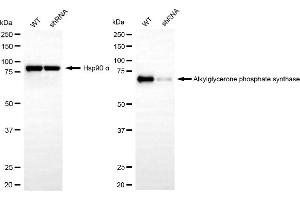 Western blotting analysis using alkylglycerone phosphate synthase antibody (ABIN7797582). (Recombinant AGPS 抗体)