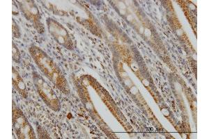 Immunoperoxidase of monoclonal antibody to GMPS on formalin-fixed paraffin-embedded human small Intestine. (GMP Synthase 抗体  (AA 108-215))