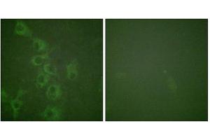 Immunofluorescence analysis of HuvEc cells, using Histamine H1 Receptor (Phospho-Ser398) antibody. (HRH1 抗体  (pSer398))